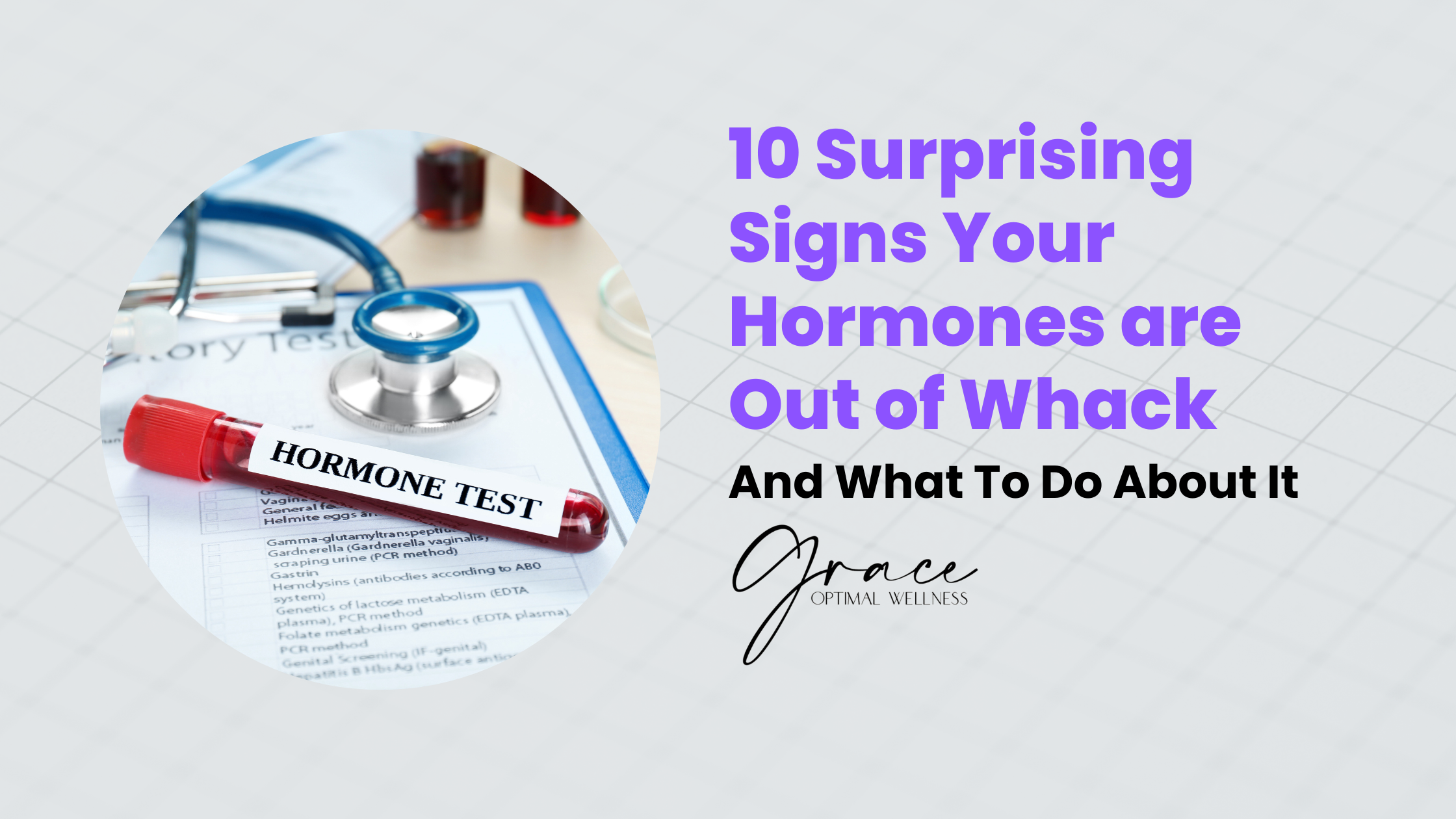 10 Surprising Signs Your Hormones Are Out of Whack (And How to Fix Them)